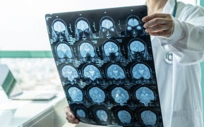 Developing Drugs Able to Treat Neurological Disease – Boston Biotech Clinical Research