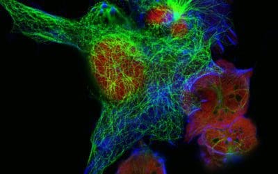 Orphan drug for rare cancers: New therapies for Neuroblastoma