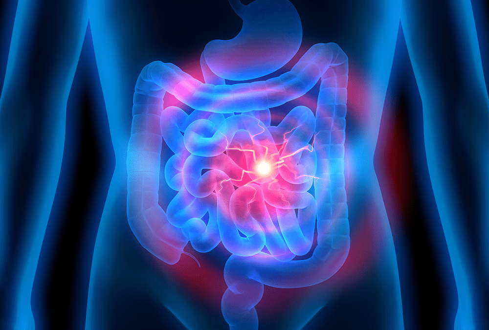 Obesity Associated Gut Microbiota Alterations Worsen GVHD