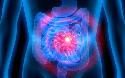 Obesity Associated Gut Microbiota Alterations Worsen GVHD